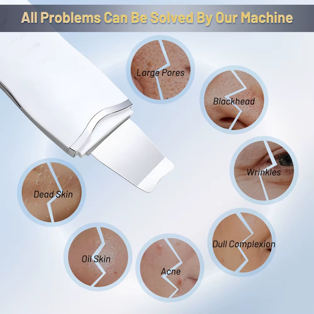 Ultrasonic Skin Scrubber Ance Pore Cleaner Peeling Blackhead Remover Deep Face Cleaning Ultrasonic Ion Facial Shovel Cleanser
