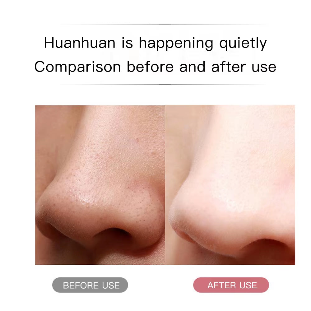 Ultrasonic Skin Scrubber Ance Pore Cleaner Peeling Blackhead Remover Deep Face Cleaning Ultrasonic Ion Facial Shovel Cleanser